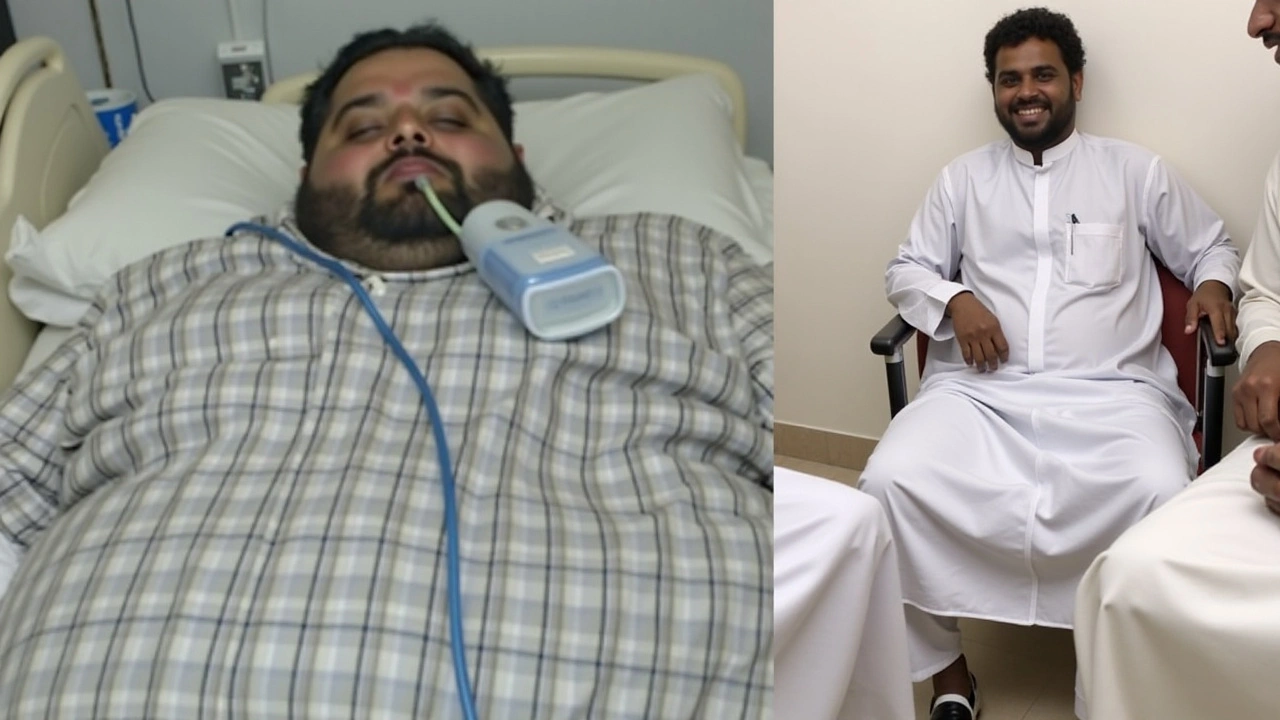 Saudi Arabian Man Loses Over 500 Kg: Incredible Transformation Story